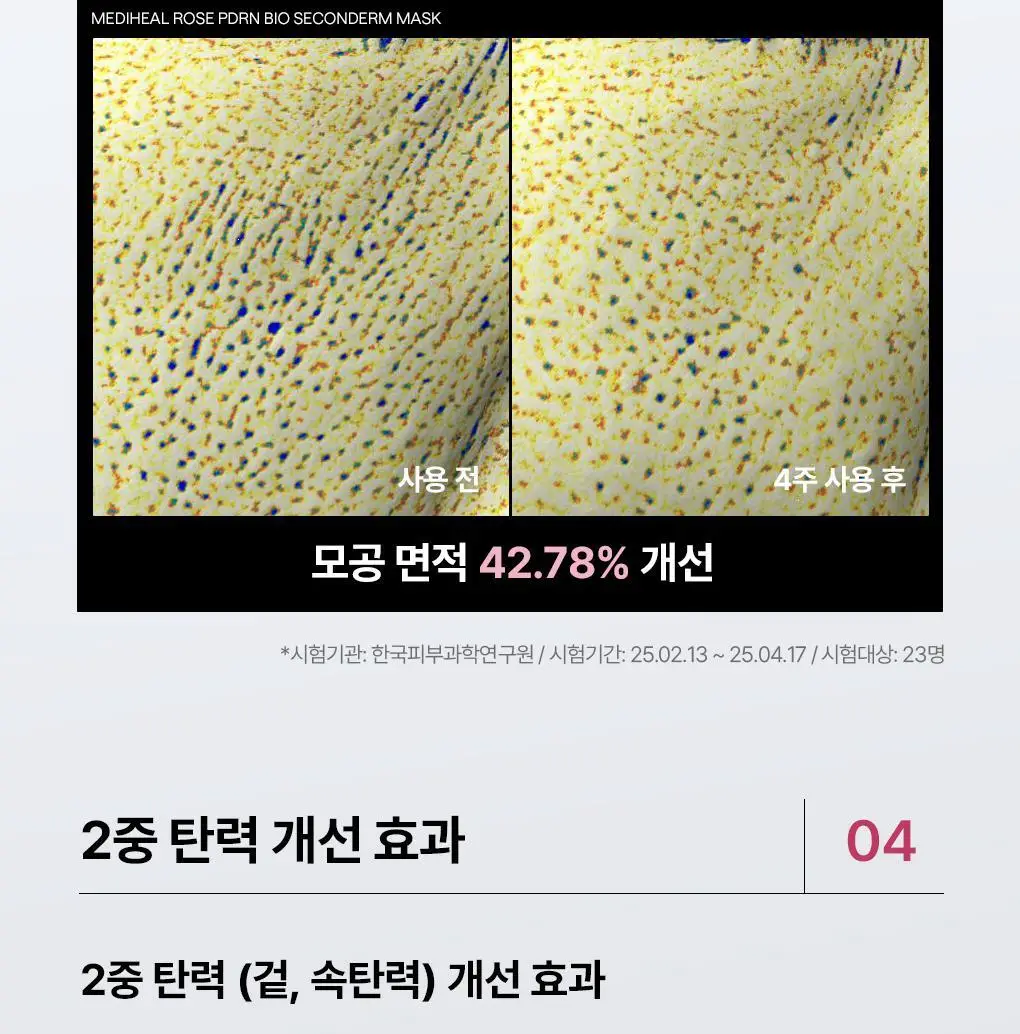 [피지흡착/모공쿨링] 메디힐 바이오 세컨덤 마스크 1매 3종 (마데카소사이드, PDRN, 히알루론산) 상세페이지 36